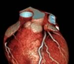 Что мы знаем о признаках сердечного приступа?